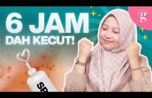 Nak Jerawat Cepat Kecut? Ini 5 Produk Terbaik 2025 Yang Wajib Cuba! (Review 2025)