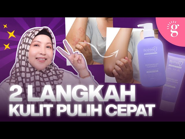 Kuit Sensitif & Ekzema? Ini Cara Pilih Produk Yang Betul | Review Bioshield Sensitive DermaRelief