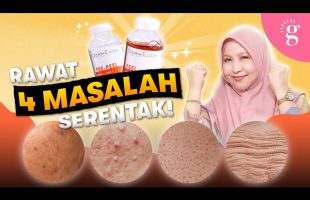 Cara Atasi Dark Spots, Pori Besar, Jerawat & Garis Halus Dengan Satu Produk