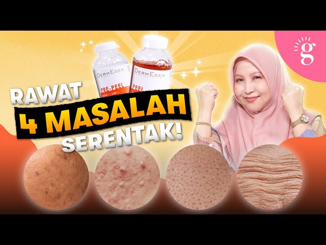 Cara Atasi Dark Spots, Pori Besar, Jerawat & Garis Halus Dengan Satu Produk