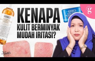 Cara Pulihkan Kulit Berminyak Yang Sensitif | Kiehl’s Calendula Toner & Ultra Facial Oil-Free Gel