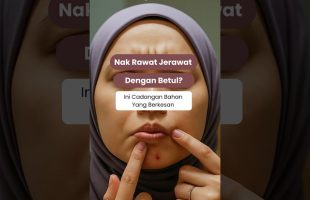 Kecutkan Jerawat Dengan Berkesan