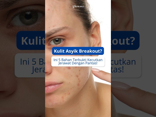 5 Bahan Berkesan Kecutkan Jerawat 💥