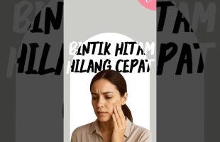 Bintik Hitam Hilang Cepat Dengan Serum Ini🤙🏻