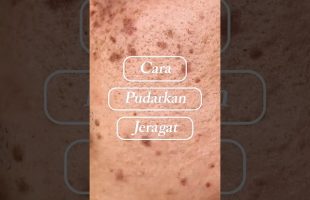 Begini Cara Pudarkan Jeragat ⚡️