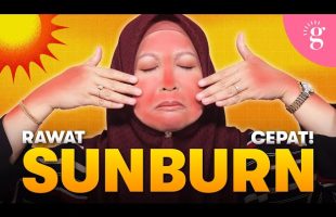 Kulit Muka Sunburn? Ini Langkah Demi Langkah Untuk Merawatnya 🌞