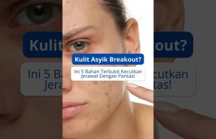 5 Bahan Berkesan Kecutkan Jerawat 💥