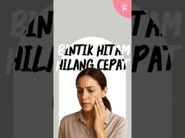 Bintik Hitam Hilang Cepat Dengan Serum Ini🤙🏻