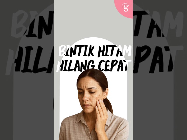 Bintik Hitam Hilang Cepat Dengan Serum Ini🤙🏻