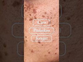 Begini Cara Pudarkan Jeragat ⚡️