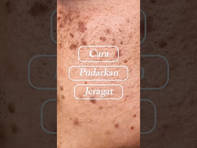 Begini Cara Pudarkan Jeragat ⚡️