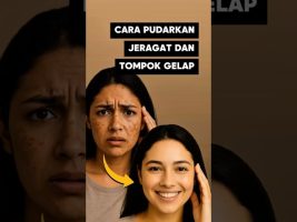 Cara Pudarkan Jeragat Dan Tompok Gelap Dengan Pantas