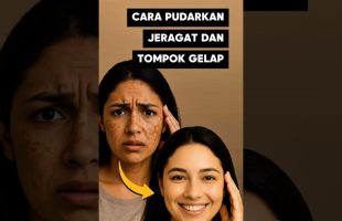 Cara Pudarkan Jeragat Dan Tompok Gelap Dengan Pantas