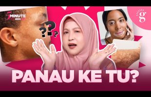 Kulit Mula Timbul Tompok Putih? Adakah Panau? Ini Punca Dan Cara Rawat Yang Betul