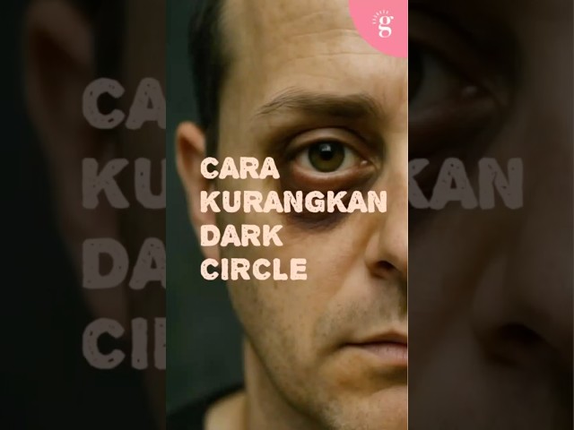 Bolehkah dark circle dihilangkan? Apakah caranya?