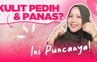 Anda Remaja Yang Baru Nak Belajar Pakai Skincare? Ini 5 Langkah Penting Kulit Sihat dan Glowing!