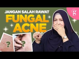 Cara Rawat Fungal Acne Dengan Betul Dan Selamat