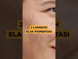 2 Cara Elak Pigmentasi
