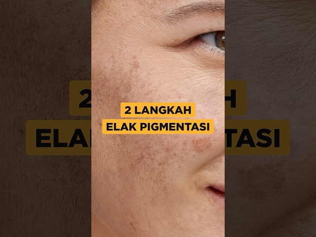 2 Cara Elak Pigmentasi