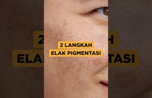 2 Cara Elak Pigmentasi