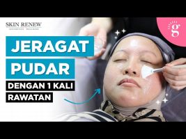 Cara Pudarkan Jeragat Dengan Pantas