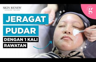 Cara Pudarkan Jeragat Dengan Pantas