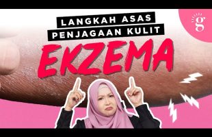 Rutin Asas Penjagaan Kulit Ekzema