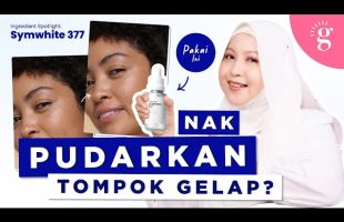 Cara Pudarkan Tompok Gelap Dengan SymWhite 377 Dan Cadangan Produk Yang Bagus Di Pasaran