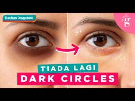 Cara Pudarkan Dark Circles Atau Mata Panda