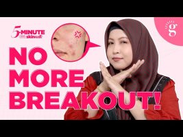 Cara Rawat dan Pulihkan Kulit Muka Yang Breakout
