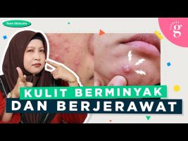 Pilihan Skincare Untuk Remaja Kulit Berminyak Dan Berjerawat