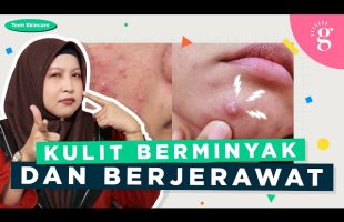 Pilihan Skincare Untuk Remaja Kulit Berminyak Dan Berjerawat