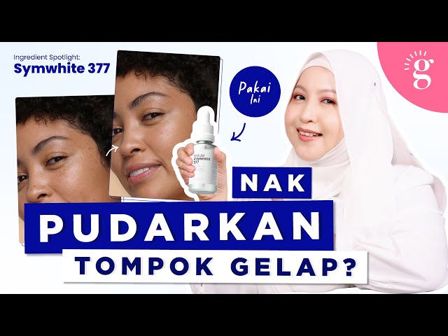 Cara Pudarkan Tompok Gelap Dengan SymWhite 377 Dan Cadangan Produk Yang Bagus Di Pasaran