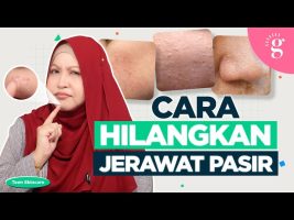Cara Hilangkan Jerawat Pasir Untuk Remaja