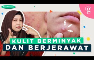 Pilihan Skincare Untuk Remaja Kulit Berminyak Dan Berjerawat