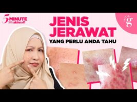 Blackheads vs Whiteheads, Papule vs Pustule, Nodule vs Cyst | Cara Hilangkan Semua Jenis Jerawat Ini