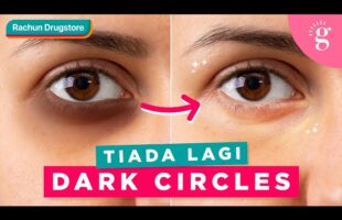 Cara Pudarkan Dark Circles Atau Mata Panda