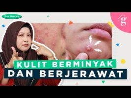 Pilihan Skincare Untuk Remaja Kulit Berminyak Dan Berjerawat