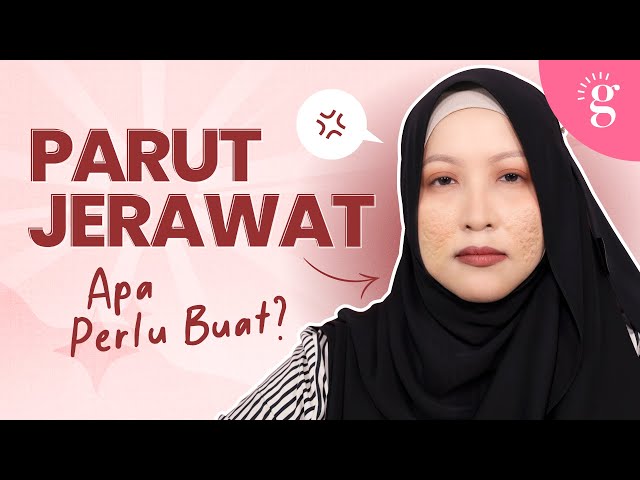 Pilihan Rawatan Estetik Untuk Parut