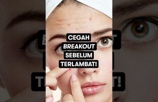 Cegah Breakout Sebelum Terlambat!