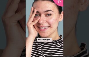 Kenapa muka yang berjerawat tidak digalakkan memakai skrub?