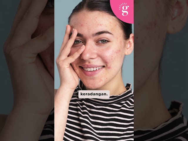 Kenapa muka yang berjerawat tidak digalakkan memakai skrub?