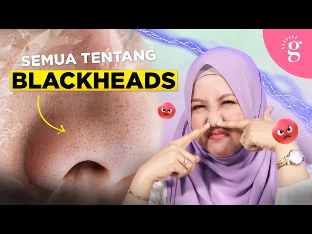 Kompilasi Video-Video Glowwe 3: Blackheads & Open Comedones