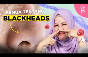 Kompilasi Video-Video Glowwe 3: Blackheads & Open Comedones
