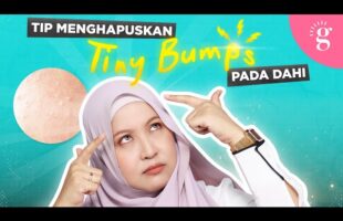Tip Menghapuskan Tiny Bumps Pada Dahi