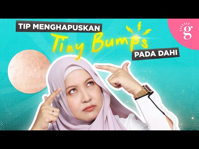 Tip Menghapuskan Tiny Bumps Pada Dahi