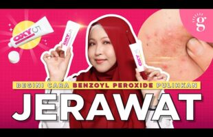 Bagaimana Benzoyl Peroxide Pulihkan Jerawat? I Review Mentholatum Oxy 5 & Oxy 10