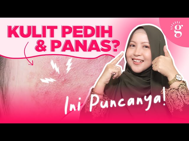 Kenapa Kulit Rasa Tegang, Pedih Dan Panas Selepas Pakai Produk Skincare?