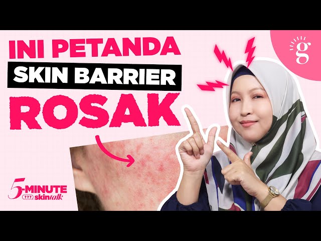 Tanda-Tanda Skin Barrier Rosak
