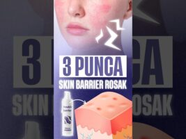 3 Punca Skin Barrier Rosak